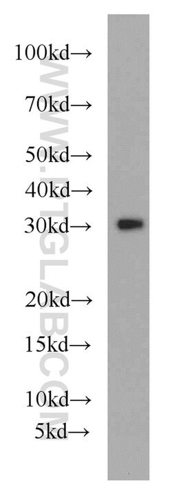 MRPL28 Rabbit anti-Human, Mouse, Rat, Polyclonal, Proteintech:Antibodies:Primary