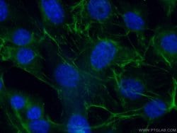 ADIPOQ Rabbit anti-Human, Mouse, Polyclonal, Proteintech:Antibodies:Primary