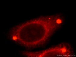 TMED9 Rabbit anti-Human, Mouse, Rat, Polyclonal, Proteintech 150 &mu;L;