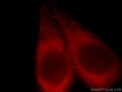 TMED9 Rabbit anti-Human, Mouse, Rat, Polyclonal, Proteintech 150 &mu;L;