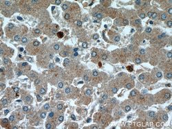 TMED9 Rabbit anti-Human, Mouse, Rat, Polyclonal, Proteintech 150 &mu;L;