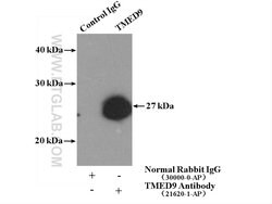 TMED9 Rabbit anti-Human, Mouse, Rat, Polyclonal, Proteintech 150 &mu;L;