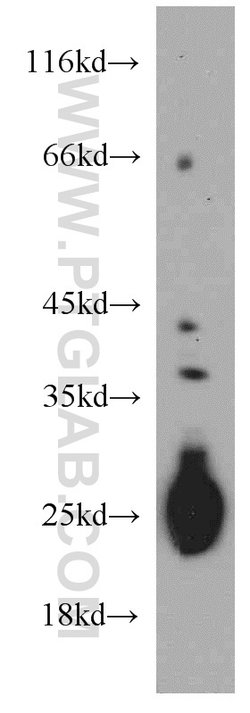 TMED9 Rabbit anti-Human, Mouse, Rat, Polyclonal, Proteintech 150 &mu;L;