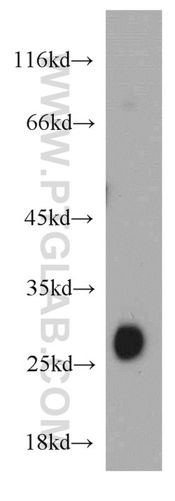 TMED9 Rabbit anti-Human, Mouse, Rat, Polyclonal, Proteintech 150 &mu;L;