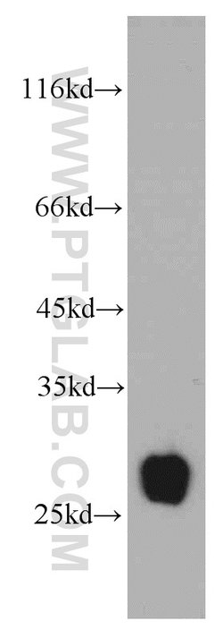 TMED9 Rabbit anti-Human, Mouse, Rat, Polyclonal, Proteintech 150 &mu;L;