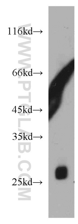 TMED9 Rabbit anti-Human, Mouse, Rat, Polyclonal, Proteintech 150 &mu;L;