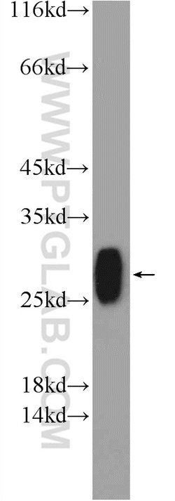 TMED9 Rabbit anti-Human, Mouse, Rat, Polyclonal, Proteintech 150 &mu;L;
