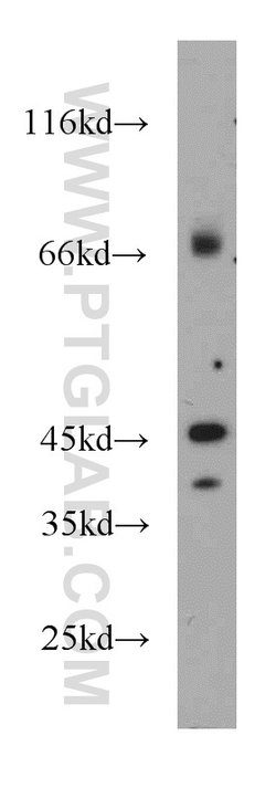 GPBP1 Rabbit anti-Human, Mouse, Rat, Polyclonal, Proteintech 150 &mu;L;