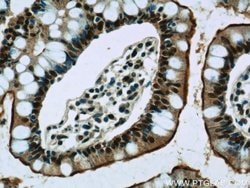 GPBP1 Rabbit anti-Human, Mouse, Rat, Polyclonal, Proteintech 150 &mu;L;