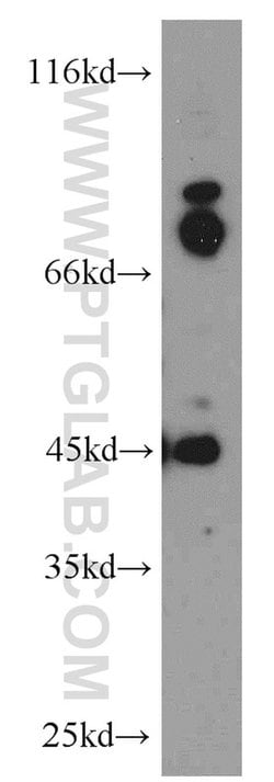 GPBP1 Rabbit anti-Human, Mouse, Rat, Polyclonal, Proteintech 150 &mu;L;