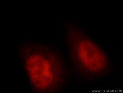 RNF20 Rabbit anti-Human, Mouse, Rat, Polyclonal, Proteintech:Antibodies:Primary