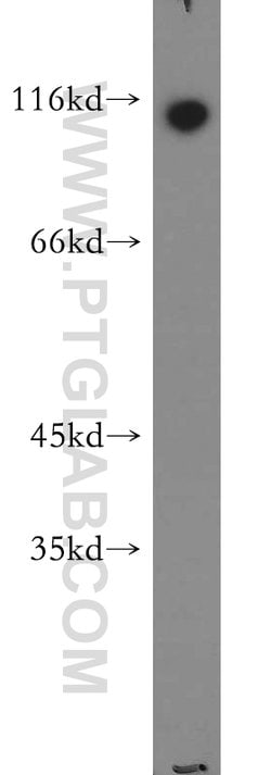 RNF20 Rabbit anti-Human, Mouse, Rat, Polyclonal, Proteintech:Antibodies:Primary