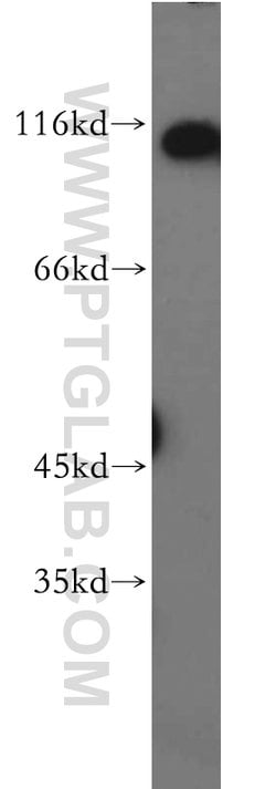 RNF20 Rabbit anti-Human, Mouse, Rat, Polyclonal, Proteintech:Antibodies:Primary