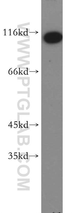 RNF20 Rabbit anti-Human, Mouse, Rat, Polyclonal, Proteintech:Antibodies:Primary
