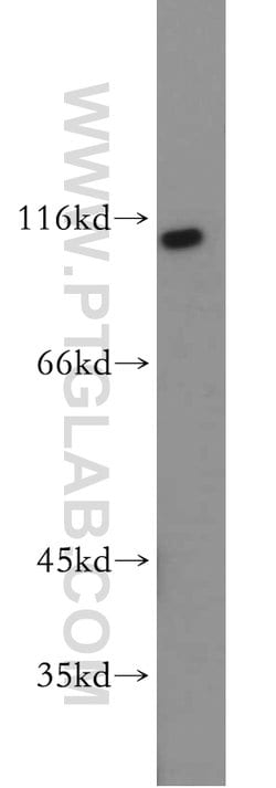 RNF20 Rabbit anti-Human, Mouse, Rat, Polyclonal, Proteintech:Antibodies:Primary