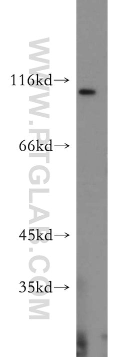 RNF20 Rabbit anti-Human, Mouse, Rat, Polyclonal, Proteintech:Antibodies:Primary