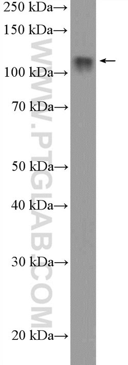 RNF20 Rabbit anti-Human, Mouse, Rat, Polyclonal, Proteintech:Antibodies:Primary
