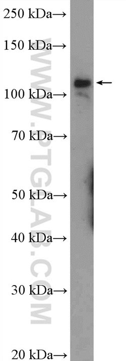 RNF20 Rabbit anti-Human, Mouse, Rat, Polyclonal, Proteintech:Antibodies:Primary