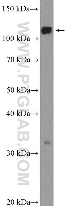 RNF20 Rabbit anti-Human, Mouse, Rat, Polyclonal, Proteintech:Antibodies:Primary