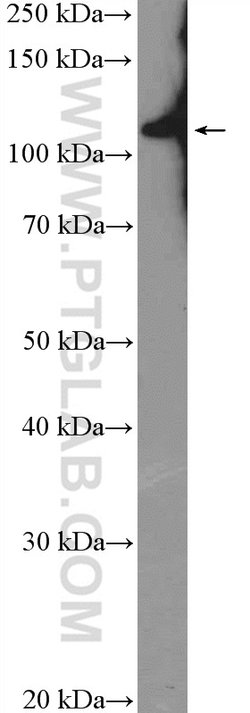 RNF20 Rabbit anti-Human, Mouse, Rat, Polyclonal, Proteintech:Antibodies:Primary