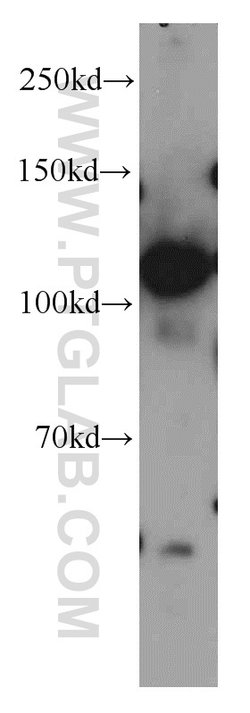 KIF5B Rabbit anti-Human, Mouse, Rat, Polyclonal, Proteintech 20 &mu;L;