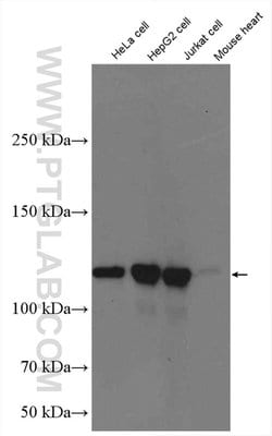 KIF5B Rabbit anti-Human, Mouse, Rat, Polyclonal, Proteintech 20 &mu;L;
