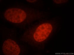 SMARCA4/BRG1 Rabbit anti-Human, Mouse, Rat, Polyclonal, Proteintech:Antibodies:Primary
