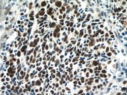 SMARCA4/BRG1 Rabbit anti-Human, Mouse, Rat, Polyclonal, Proteintech:Antibodies:Primary