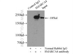 SMARCA4/BRG1 Rabbit anti-Human, Mouse, Rat, Polyclonal, Proteintech:Antibodies:Primary