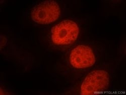 SMARCA4/BRG1 Rabbit anti-Human, Mouse, Rat, Polyclonal, Proteintech:Antibodies:Primary