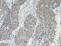 SMARCA4/BRG1 Rabbit anti-Human, Mouse, Rat, Polyclonal, Proteintech:Antibodies:Primary