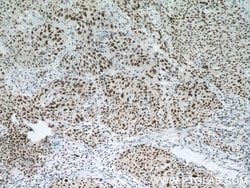 SMARCA4/BRG1 Rabbit anti-Human, Mouse, Rat, Polyclonal, Proteintech:Antibodies:Primary