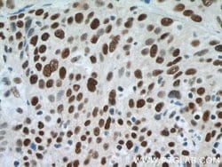 SMARCA4/BRG1 Rabbit anti-Human, Mouse, Rat, Polyclonal, Proteintech:Antibodies:Primary