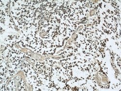SMARCA4/BRG1 Rabbit anti-Human, Mouse, Rat, Polyclonal, Proteintech:Antibodies:Primary