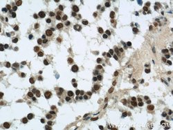SMARCA4/BRG1 Rabbit anti-Human, Mouse, Rat, Polyclonal, Proteintech:Antibodies:Primary