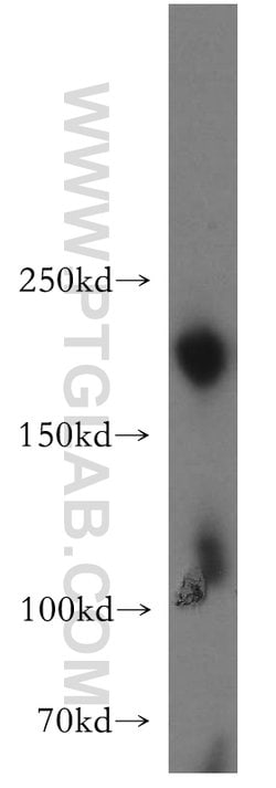SMARCA4/BRG1 Rabbit anti-Human, Mouse, Rat, Polyclonal, Proteintech:Antibodies:Primary