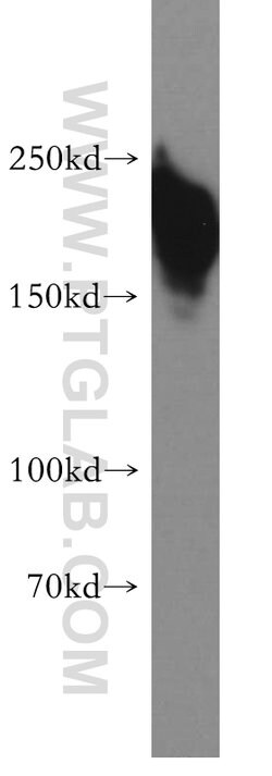 SMARCA4/BRG1 Rabbit anti-Human, Mouse, Rat, Polyclonal, Proteintech:Antibodies:Primary