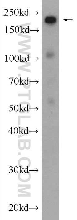 SMARCA4/BRG1 Rabbit anti-Human, Mouse, Rat, Polyclonal, Proteintech