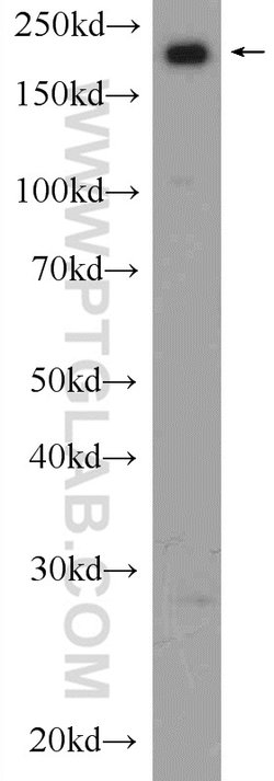 SMARCA4/BRG1 Rabbit anti-Human, Mouse, Rat, Polyclonal, Proteintech:Antibodies:Primary