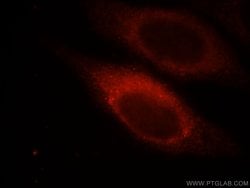 MYLK Rabbit anti-Human, Mouse, Rat, Polyclonal, Proteintech:Antibodies:Primary