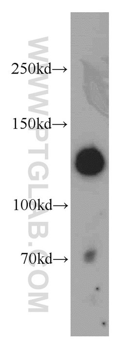 MYLK Rabbit anti-Human, Mouse, Rat, Polyclonal, Proteintech:Antibodies:Primary