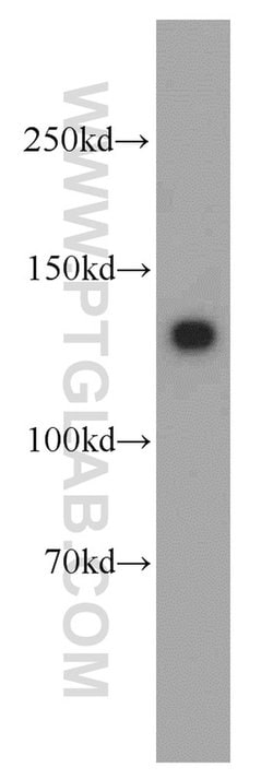 MYLK Rabbit anti-Human, Mouse, Rat, Polyclonal, Proteintech:Antibodies:Primary