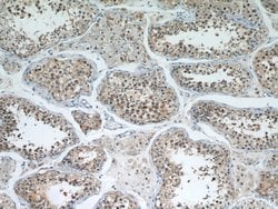 Cyclin B2 Rabbit anti-Human, Mouse, Rat, Polyclonal, Proteintech 150 &mu;L;