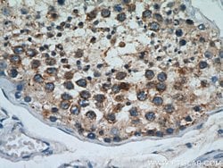 Cyclin B2 Rabbit anti-Human, Mouse, Rat, Polyclonal, Proteintech 150 &mu;L;