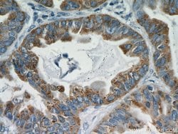 Cyclin B2 Rabbit anti-Human, Mouse, Rat, Polyclonal, Proteintech 150 &mu;L;