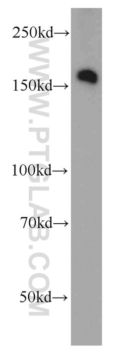 ROCK2(middle) Rabbit anti-Human, Mouse, Rat, Polyclonal, Proteintech 20