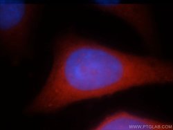 RAB3GAP1 Rabbit anti-Human, Mouse, Rat, Polyclonal, Proteintech 150 &mu;L;