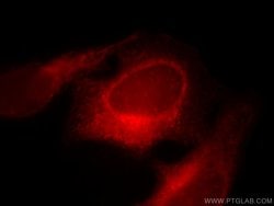 RAB3GAP1 Rabbit anti-Human, Mouse, Rat, Polyclonal, Proteintech 150 &mu;L;