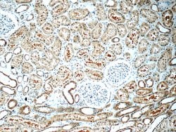 RAB3GAP1 Rabbit anti-Human, Mouse, Rat, Polyclonal, Proteintech 150 &mu;L;