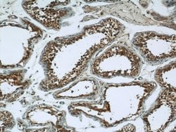 RAB3GAP1 Rabbit anti-Human, Mouse, Rat, Polyclonal, Proteintech 150 &mu;L;